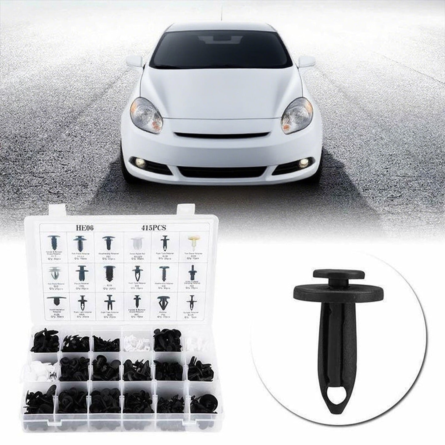 100-piece car fastener clip set — view 3