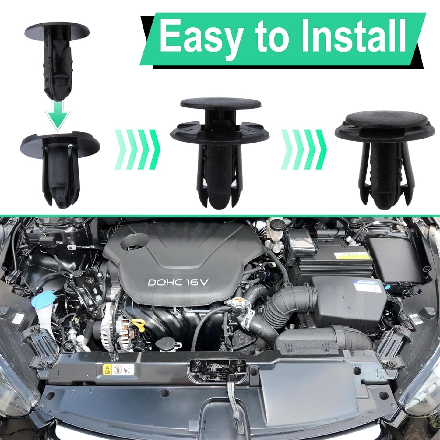 Fender liner retainer clips Hyundai Kia 20 pack — view 6