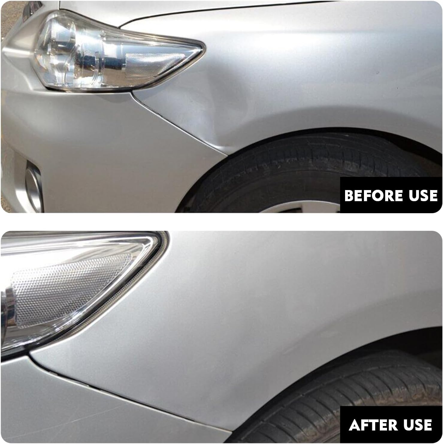 Car dent remover puller kit — view 6