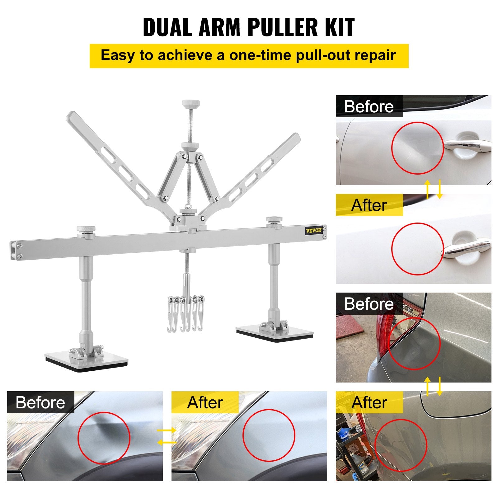 Dent Pull Lever Bar Kit — view 4